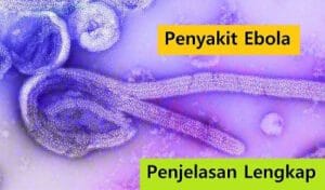 Penyakit Ebola - Sispendik